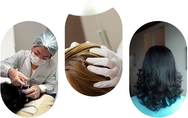 Valesca Rodrigues terapia capilar
